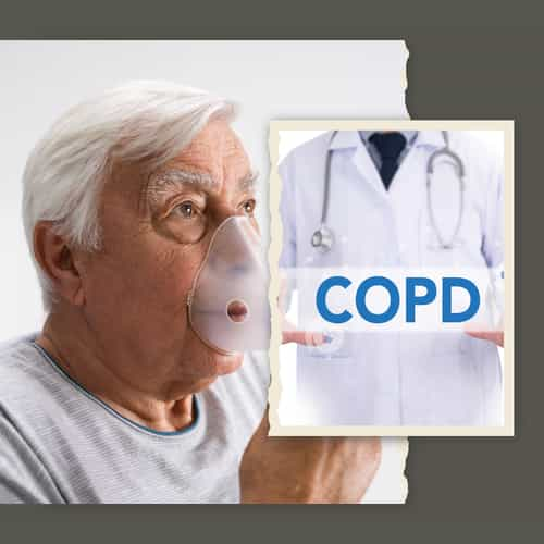 Tackling COPD: Why Canadians Are Opting for Stem Cell Treatments in Colombia